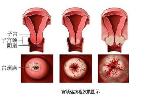 备孕前我们先深入了解一下<em>子宫</em>和<em>子宫</em>垃圾